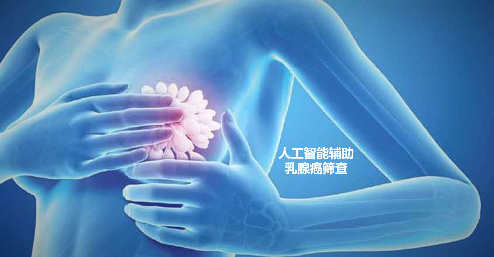 人工智能辅助乳腺癌筛查.png